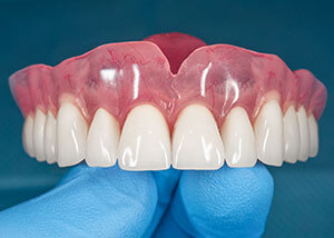 treatment dental crown procedure kellyville