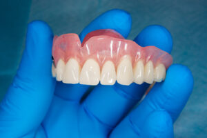 dentures before and after kellyville